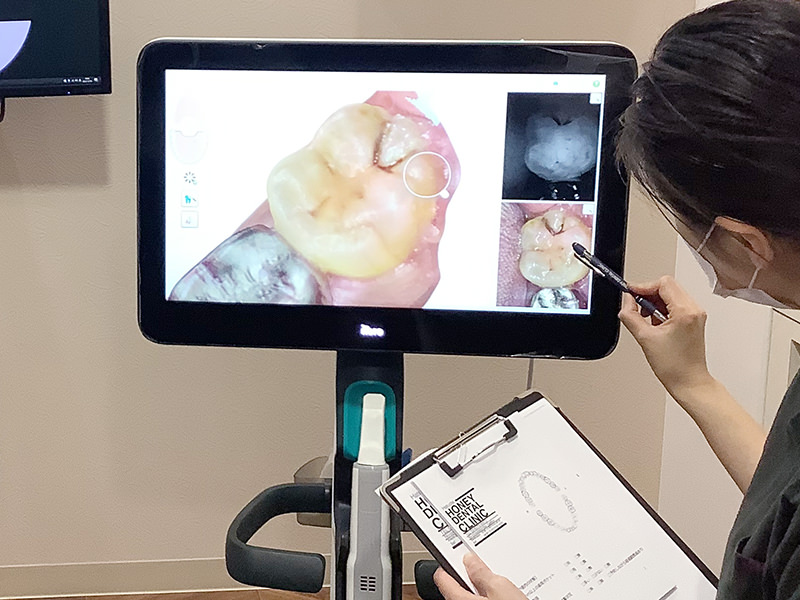 検診では画像で診断説明